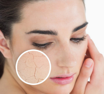 how to get rid of dry skin on face