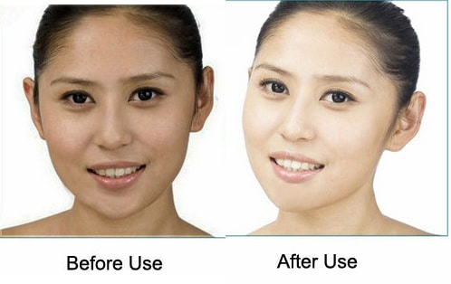 before and after aloe vera for skin whitening