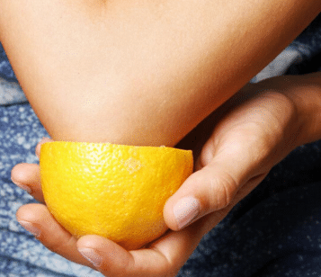 lemon juice for skin whitening