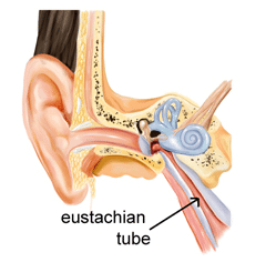 blocked eustachian tube