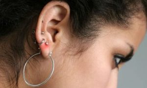 cropped How to Treat an Infected Ear Piercing