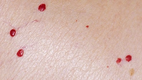 pinpoint red dots on skin not raised