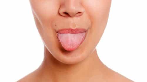 cropped Yaneff pimple on tongue