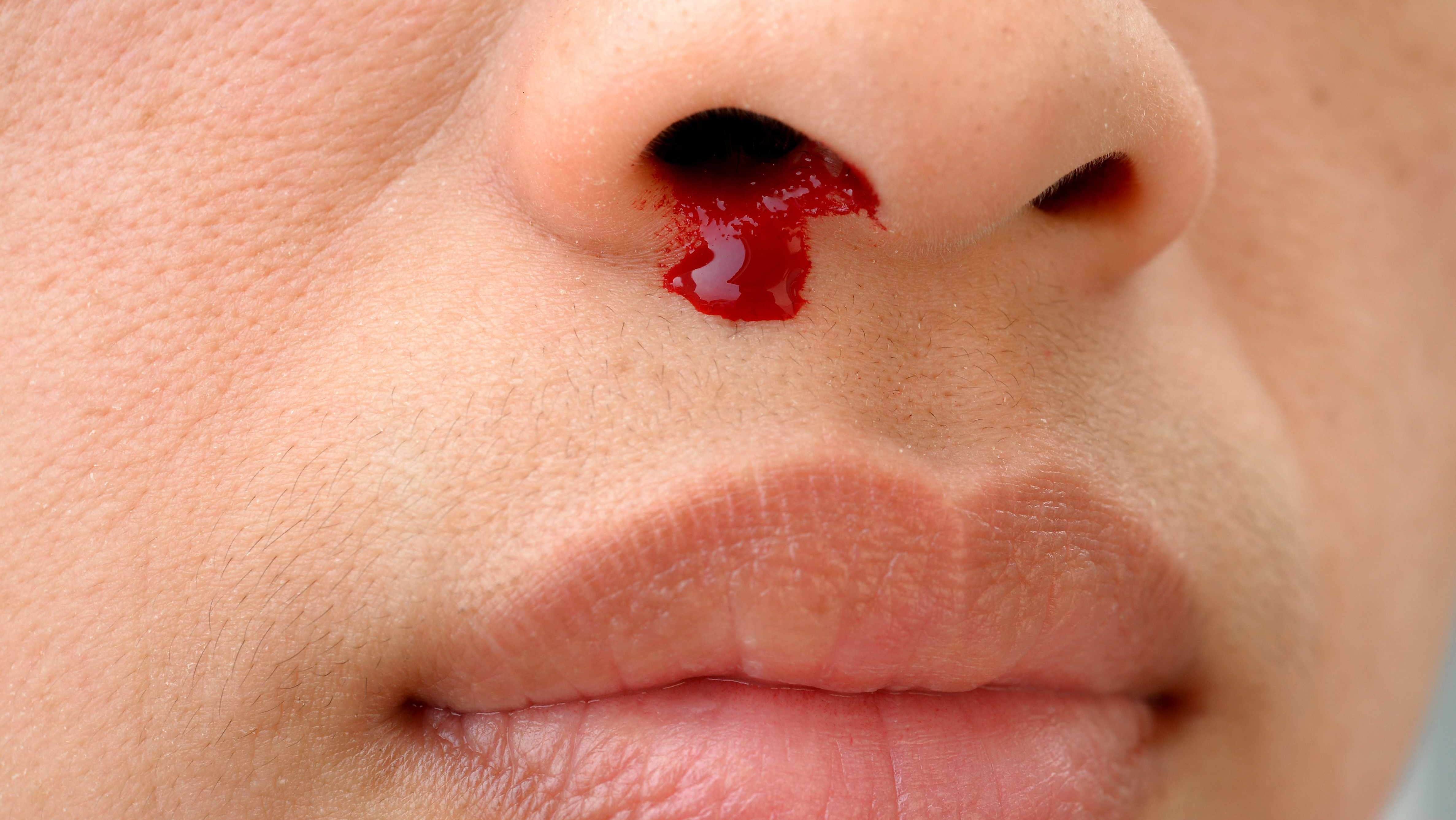 Scabs in Nose Causes: Painful, Bloody, Treatment, Home ...