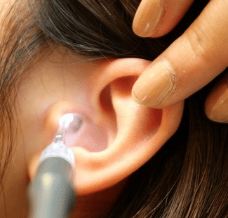 hydrogen peroxide in ear benefits