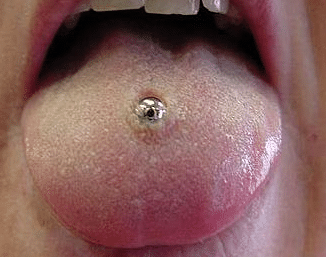 tongue piercing pain