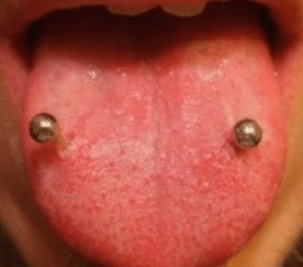 venom bite tongue piercing