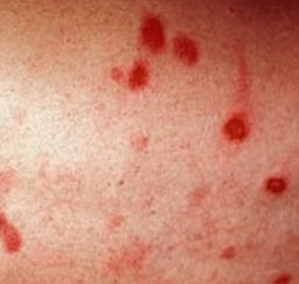 red bumps on skin