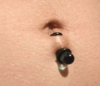 Bottom navel piercing rejection