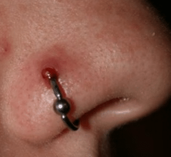nose piercing healing