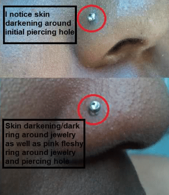 nose piercing healing