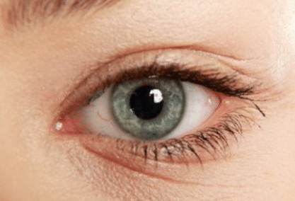 how to get rid of under eye wrinkles 